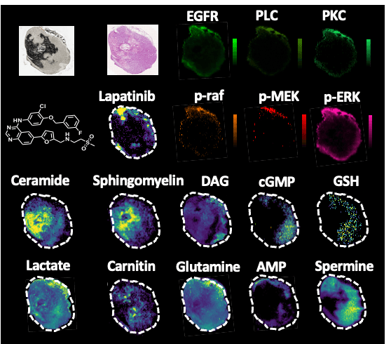 Spatial Multi-Omics